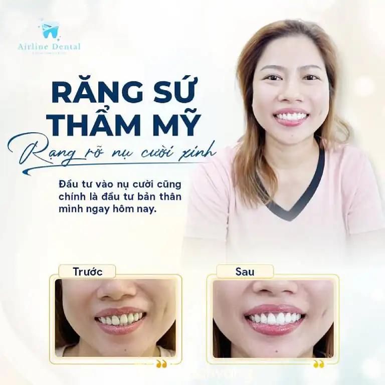 Hình ảnh Airline Dental: 7 Trần Hưng Đạo, Quận 5