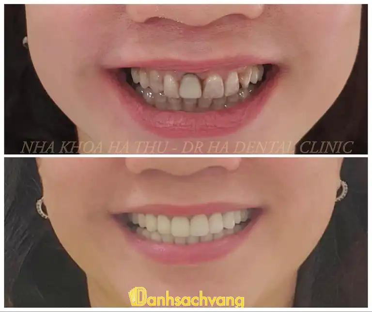 Hình ảnh nha-khoa-ha-thu-drha-dental-clinic-2