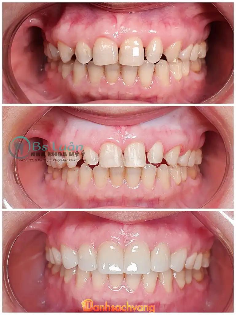 Hình ảnh nha-khoa-my-y-dental-clinic-2