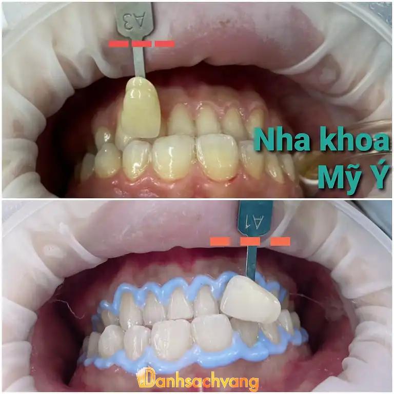Hình ảnh nha-khoa-my-y-dental-clinic-4