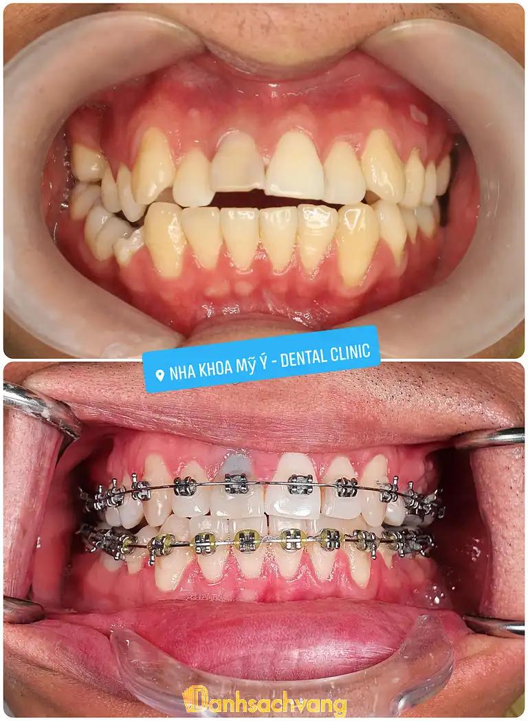 Hình ảnh nha-khoa-my-y-dental-clinic-3