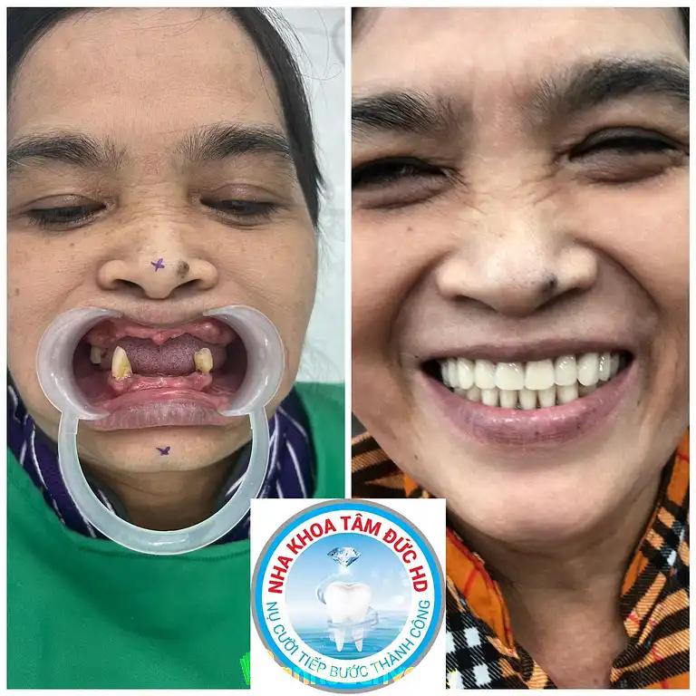 Hình ảnh nha-khoa-tam-viet-smile-tran-van-giau-pham-van-hai-binh-chanh-tphcm-4