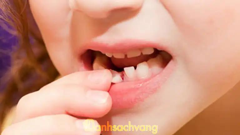 Hình ảnh dia-chi-nho-rang-sua-cho-be-tphcm