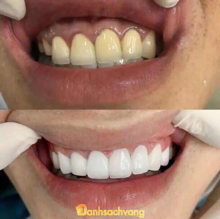 Hình ảnh nha-khoa-viet-smile-nguyen-thi-kieu-quan-12-tphcm-2