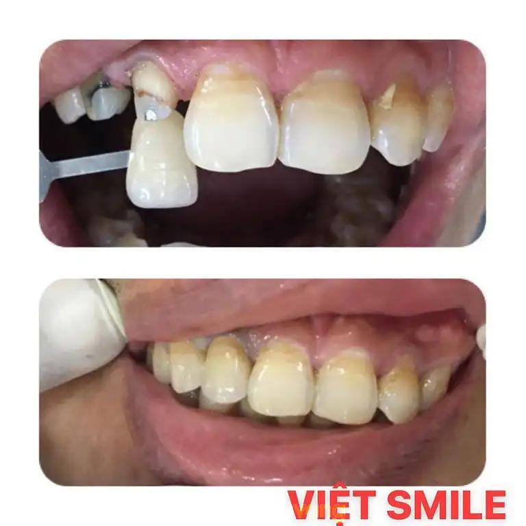 Hình ảnh nha-khoa-viet-smile-nguyen-thi-kieu-quan-12-tphcm-3
