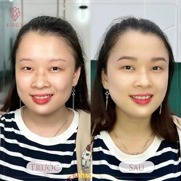Hình ảnh kimly-brows-phun-xam-tham-my-quoc-te-trung-phung-q-dong-da-ha-noi-4