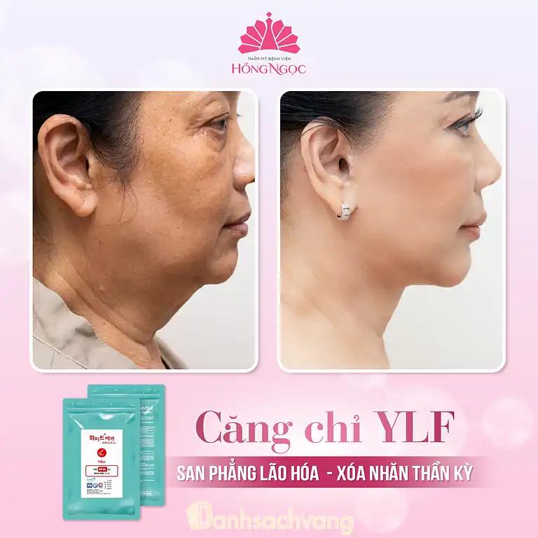 Hình ảnh tham-my-benh-vien-hong-ngoc-1