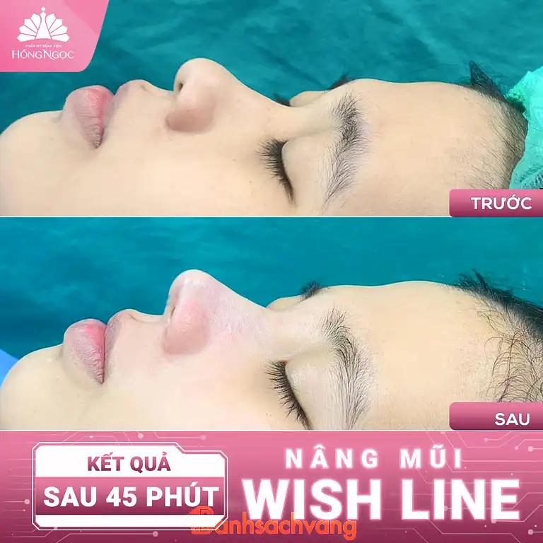 Hình ảnh tham-my-benh-vien-hong-ngoc-3