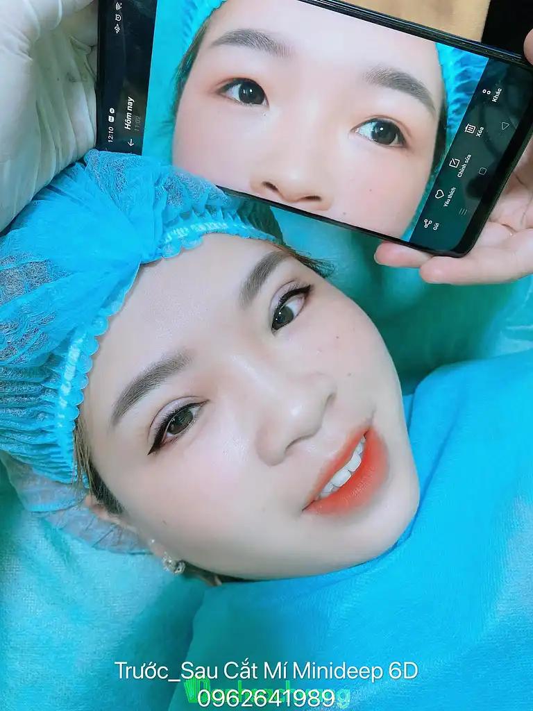 Hình ảnh tham-my-khuong-trang-16a-tap-the-cong-an-cau-buou-thanh-tri-1