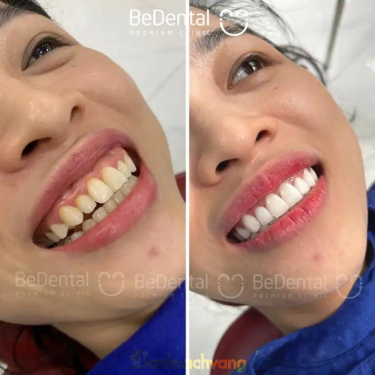 Hình ảnh nha-khoa-be-dental-343-tay-son-dong-da-2