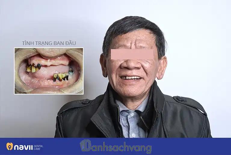 Hình ảnh navii-dental-care-42-cua-dong-hoan-kiem-3