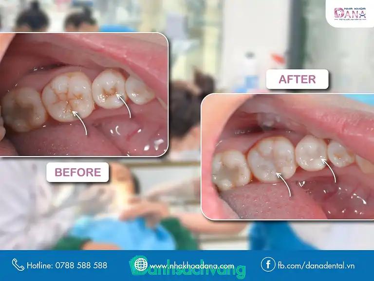 Hình ảnh dana-dental-nha-khoa-da-nang-129-nguyen-hoang-hai-chau-4