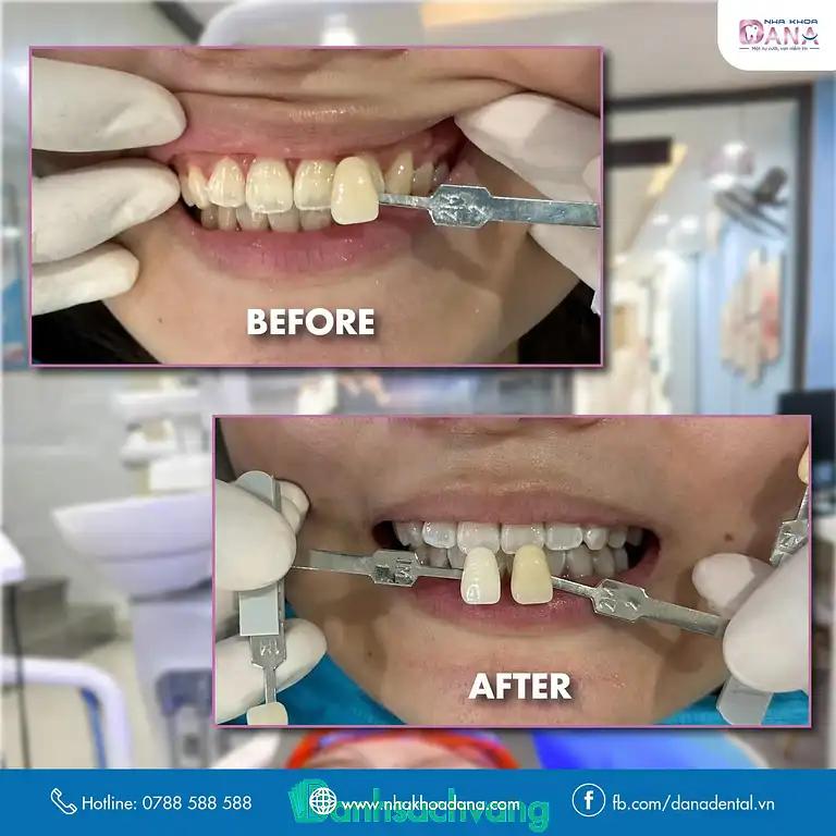 Hình ảnh dana-dental-nha-khoa-da-nang-129-nguyen-hoang-hai-chau-3