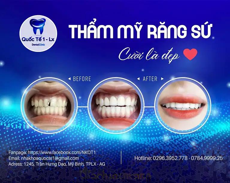 Hình ảnh Nha khoa Quốc Tế: 1245 Trần Hưng Đạo, Tp Long Xuyên, An Giang