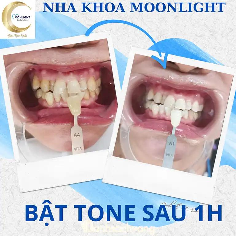 Hình ảnh nha-khoa-moonlight-102-nguyen-huu-canh-thu-dau-mot-3