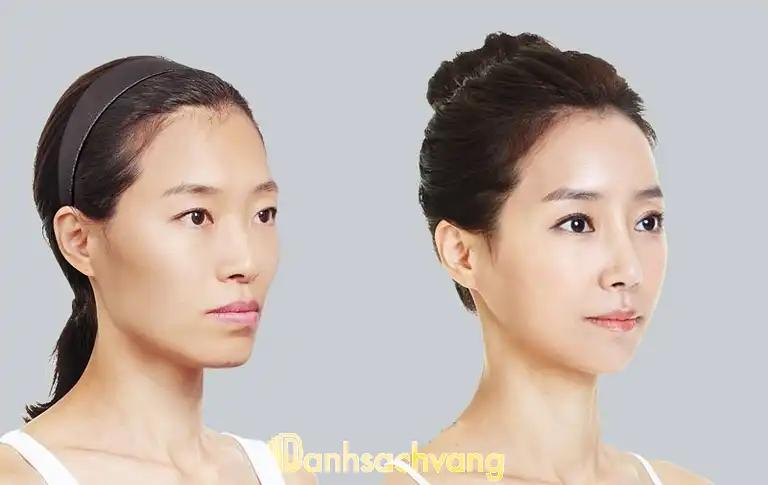 Hình ảnh dia-chi-phau-thuat-ha-go-ma-tai-tphcm-1