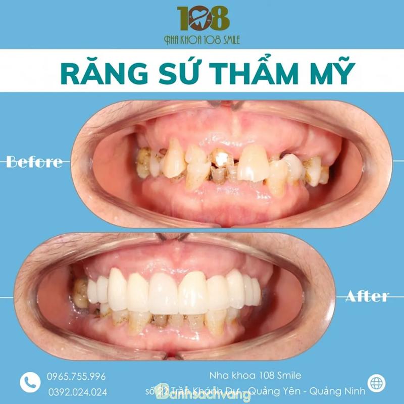 Hình ảnh Nha khoa 108 Smile quảng yên: 10 Trần Khánh Dư, TX. Quảng Yên, Quảng Ninh