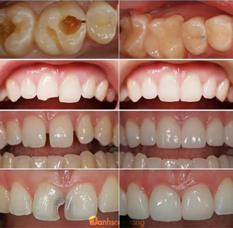 Hình ảnh Nha Khoa Hoàng Gia: 21/1 KP1 , Ấp Thanh Hoá , H.Trảng Bom