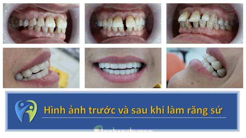 Hình ảnh Nha khoa Ninh Hiệp: 172 Trường Chinh, Tp Phúc Yên, Vĩnh Phúc