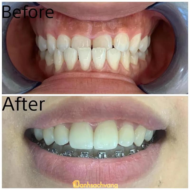 Hình ảnh Nha khoa Dr Hợi & cộng sự: 203 Sài Thị, TT. Khoái Châu, Hưng Yên