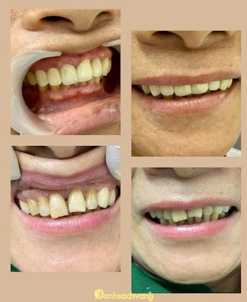 Hình ảnh Nha khoa Vàng: 77 Nguyễn Thái Học, Tp Vinh, Nghệ An