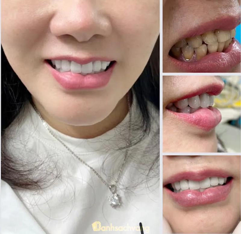 Hình ảnh Nha khoa Vàng: 77 Nguyễn Thái Học, Tp Vinh, Nghệ An