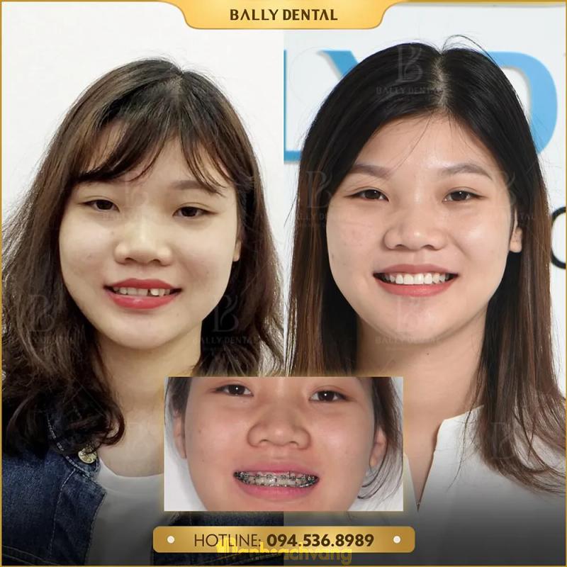 Hình ảnh Nha khoa quốc tế Bally: 463 Kim Mã, Ba Đình, Hà Nội