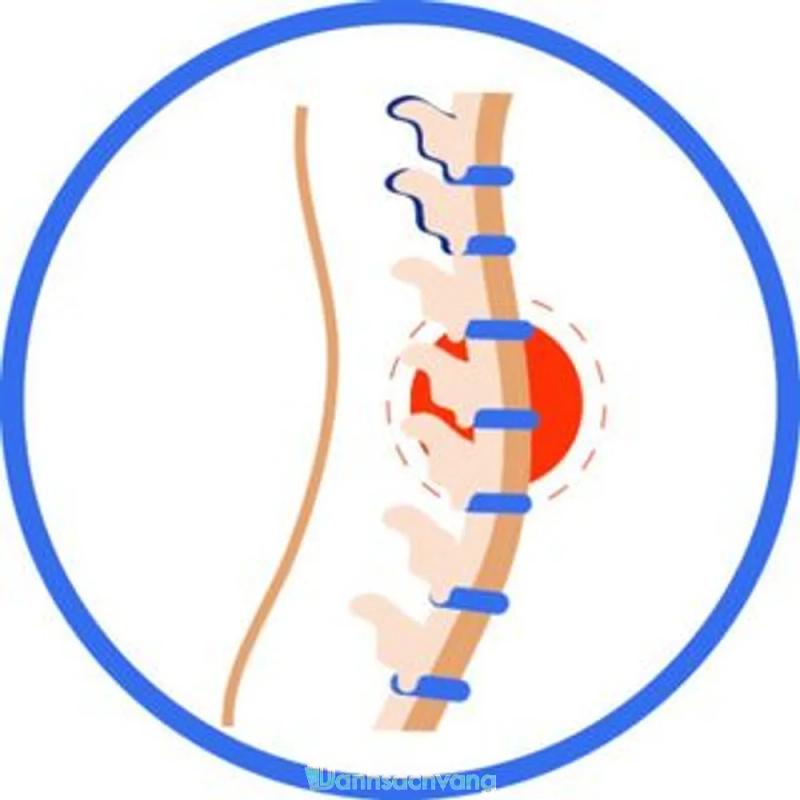 Hình ảnh Phòng Khám Cơ Xương Khớp - Chămpa Care: 94 Nguyễn Hữu Dật, Quận Tân Phú