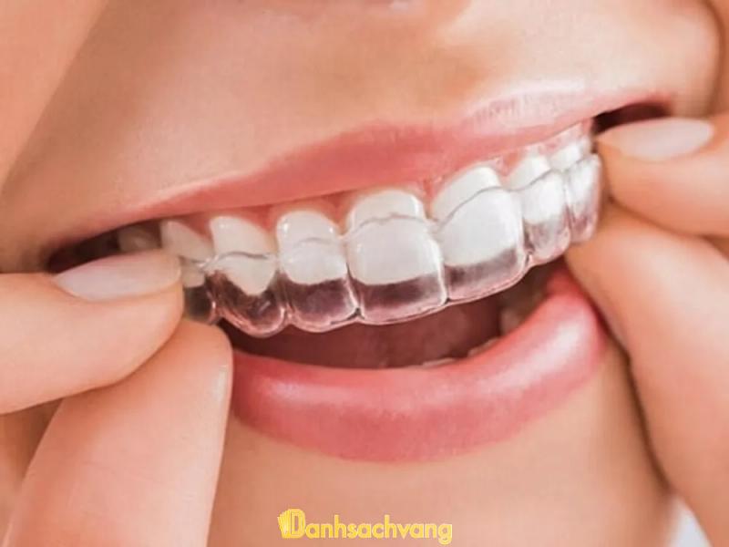 Hình ảnh 10 Địa chỉ niềng răng tại Quy Nhơn đáng tin cậy