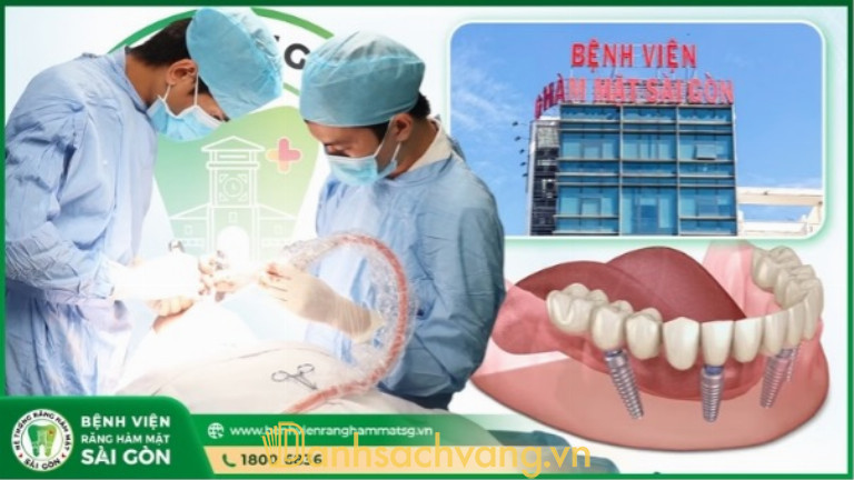 Bệnh Viện Răng Hàm Mặt Sài Gòn: Địa chỉ cấy ghép Implant