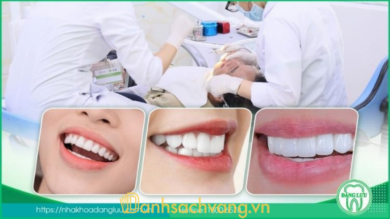 Bọc răng sứ tại Nha Khoa Đăng Lưu