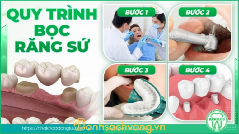 Bọc răng sứ tại Nha Khoa Đăng Lưu