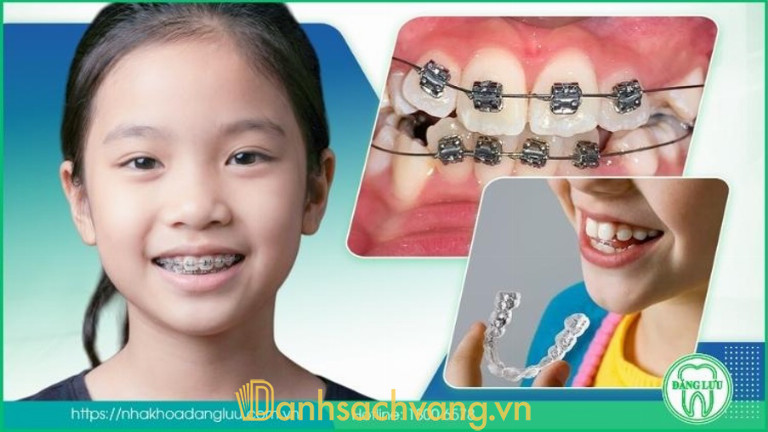 Bọc răng sứ tại Nha Khoa Đăng Lưu