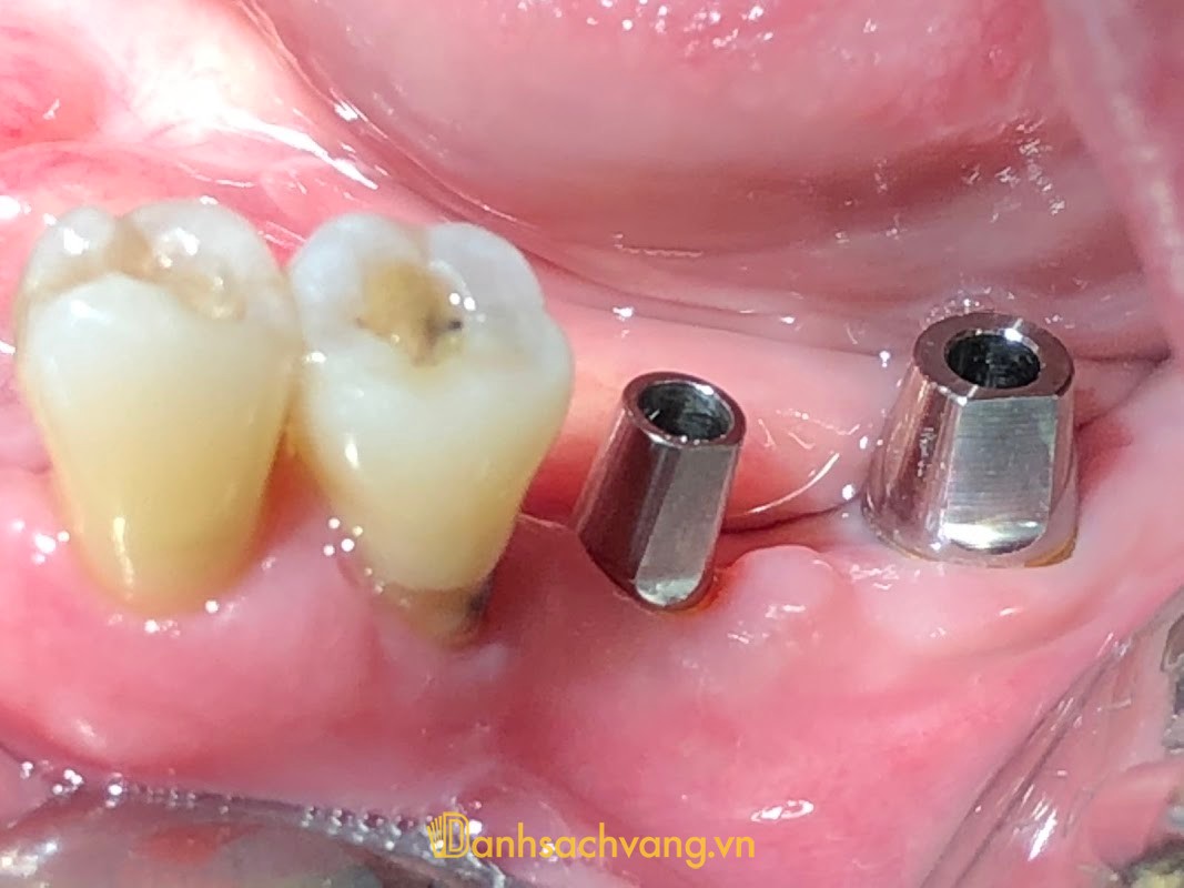 Nha Khoa Sài Gòn BS Quang TPHCM - phòng khám nha khoa ở TPHCM