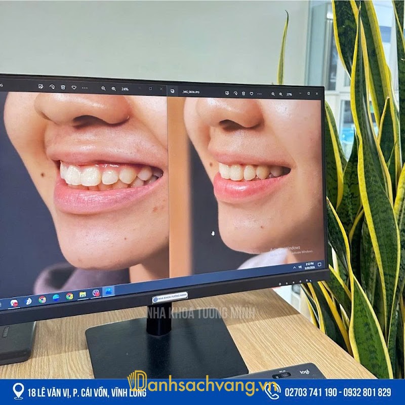 Nha Khoa Tường Minh - Vĩnh Long - 18 Lê Văn Vị, Cái Vồn