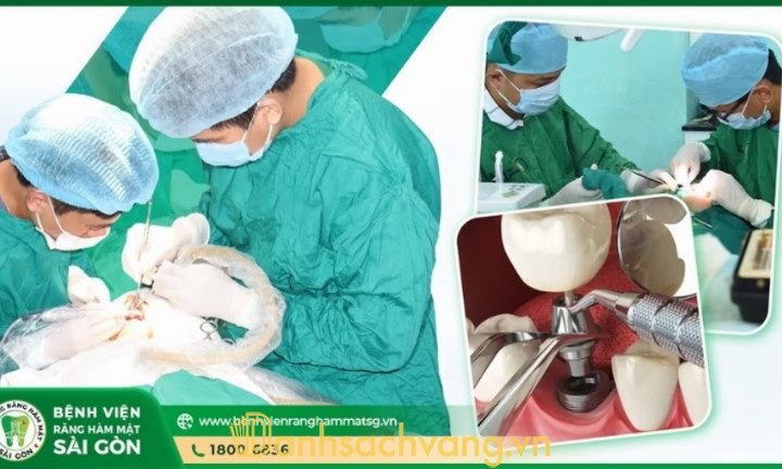 Trồng răng Implant tại Bệnh Viện Răng Hàm Mặt Sài Gòn: Hơn 5000 ca thành công