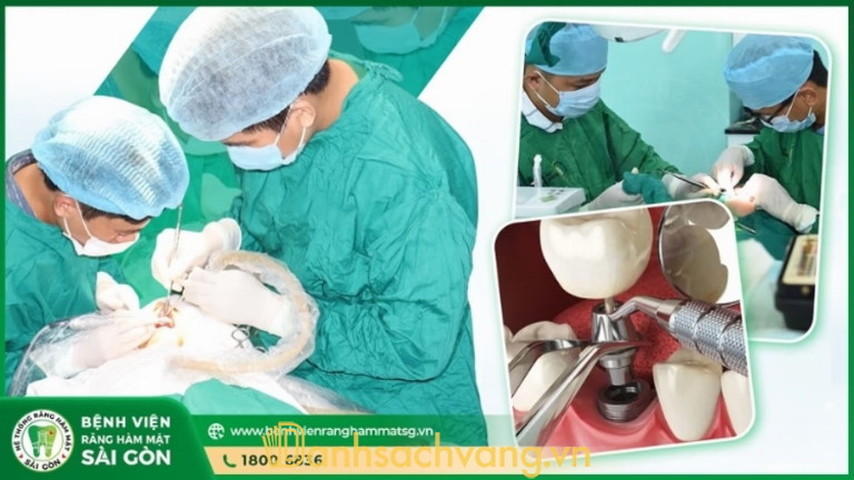 Trồng răng Implant tại Bệnh Viện Răng Hàm Mặt Sài Gòn