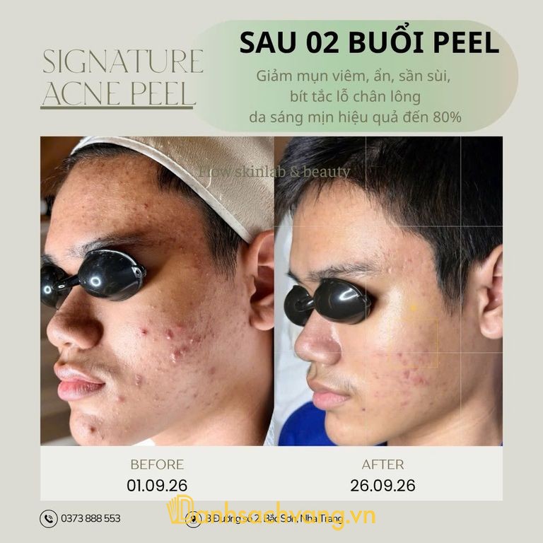 FLOW Skinlab & Beauty Spa - phun xăm tại Nha Trang