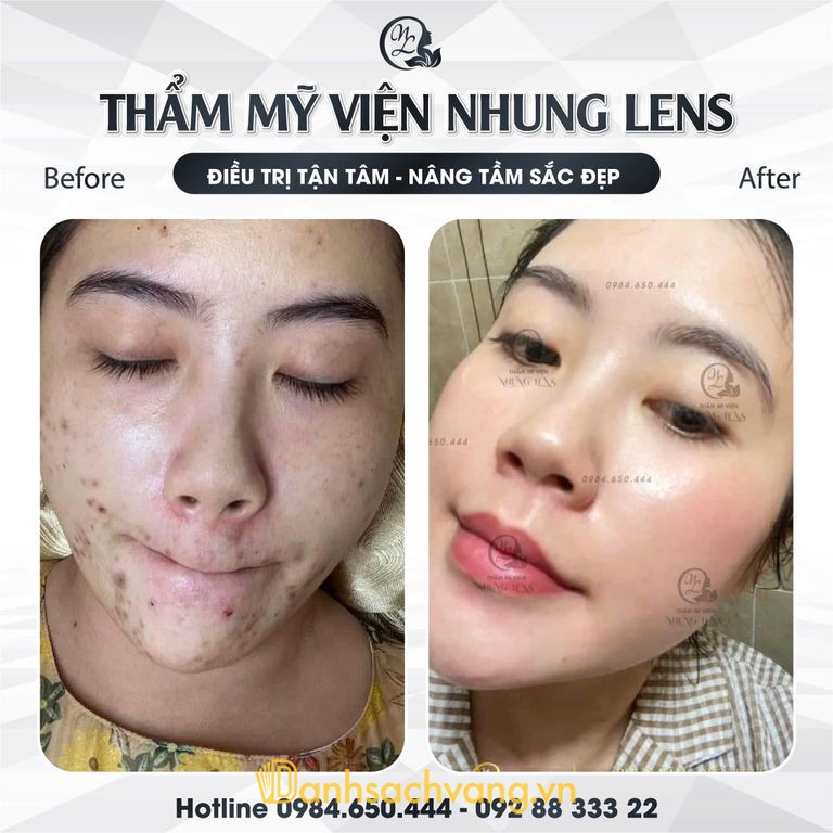 Trung Tâm Sắc Đẹp Nhung Lens tại Ninh Bình