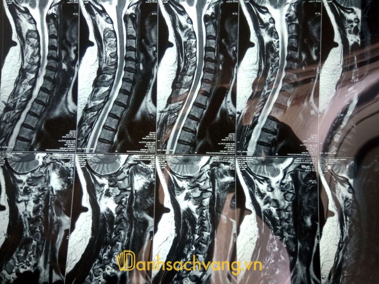 Phòng khám BS Vương chuyên khoa Cơ Xương Khớp Nha Trang