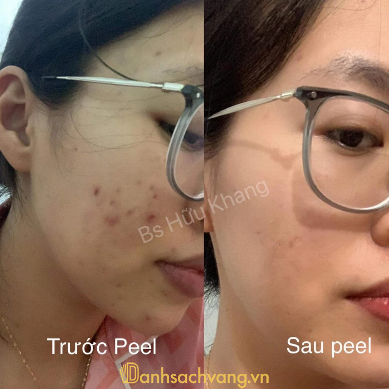 Phòng Khám Da Liễu Bác Sĩ Hữu Khang trên đường Lý Nhân Tông Bắc Ninh