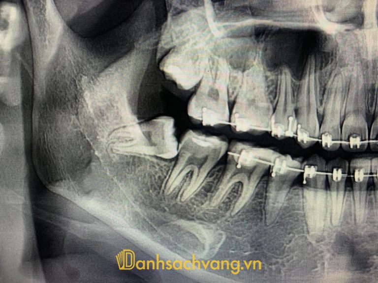 Nha Khoa BS Tài Ea Kao - phòng khám nha khoa ở Đắk Lắk