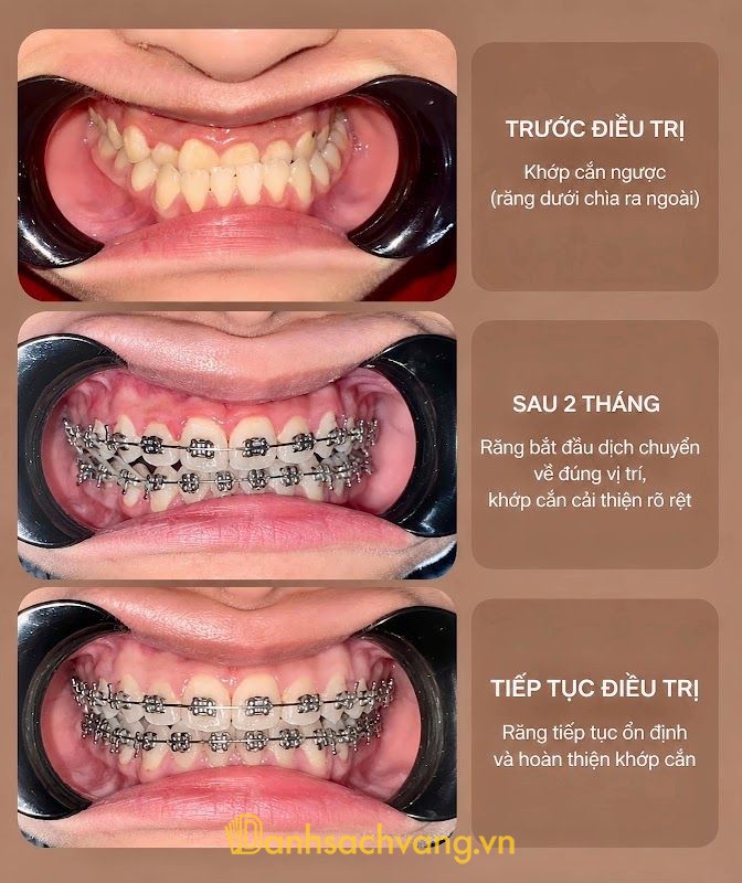 Nha Khoa Quốc Tế Tâm Anh Sơn La