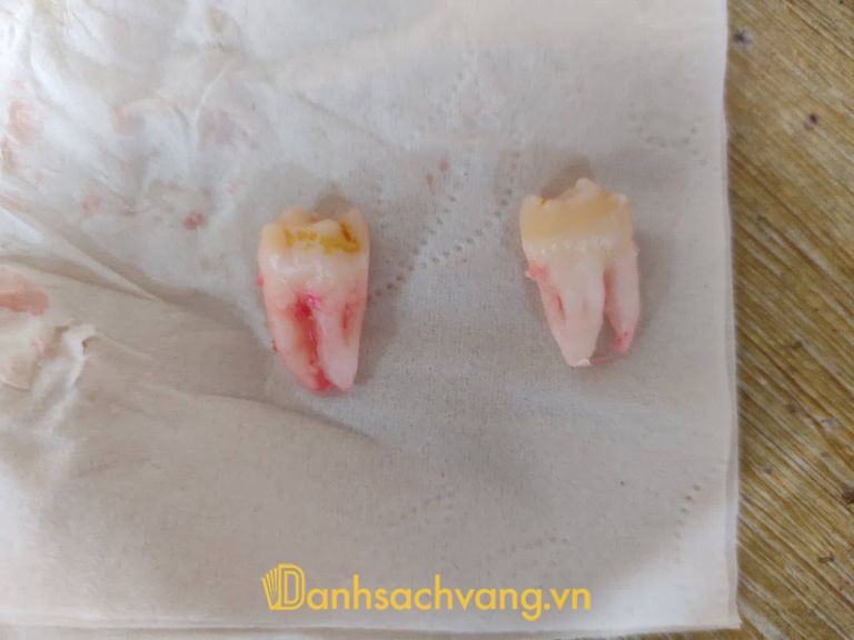 Nha Khoa Ngọc Huyền Mộc Châu