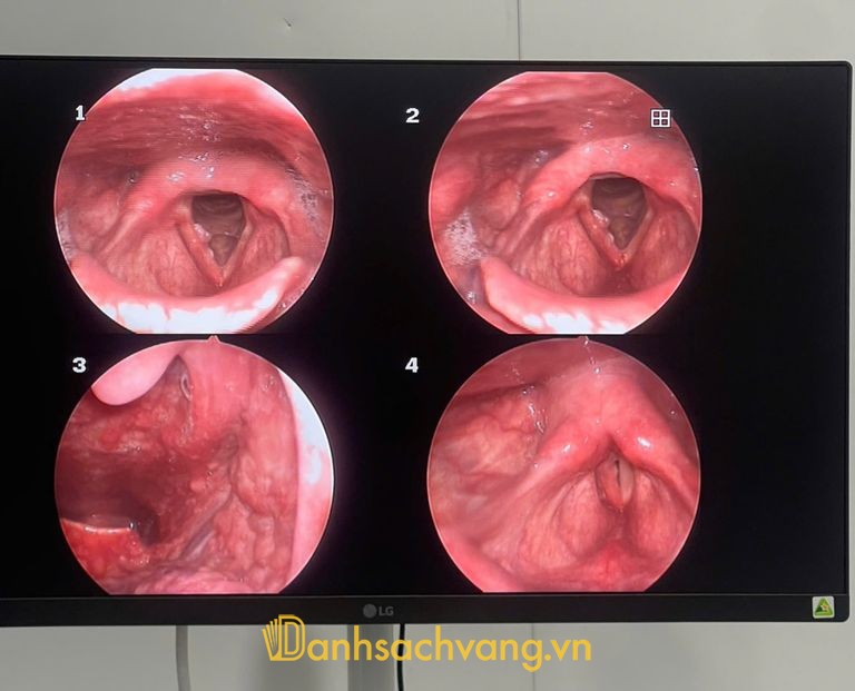 Phòng khám BS Tai Mũi Họng tại Trảng Dài Đồng Nai