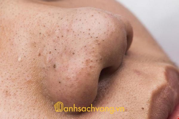 Spa Sen Mộc Quảng Trị