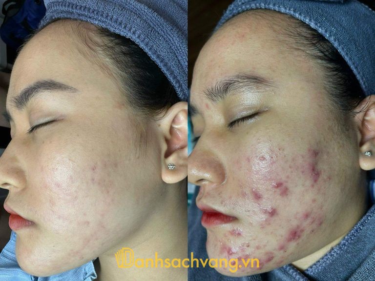 Thẩm Mỹ Viện Việt Mỹ tại 233 Trần Hưng Đạo Ninh Bình